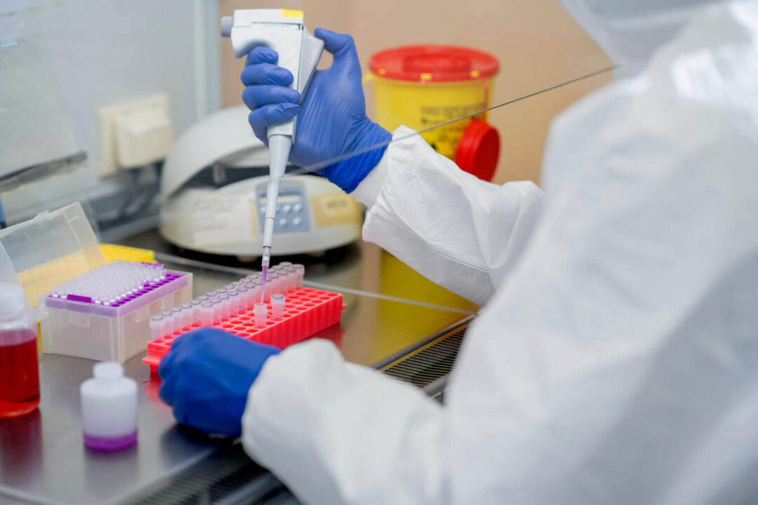 cell culture media
