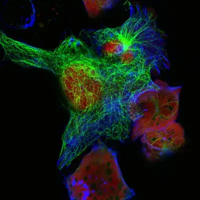 Cell Culture Media